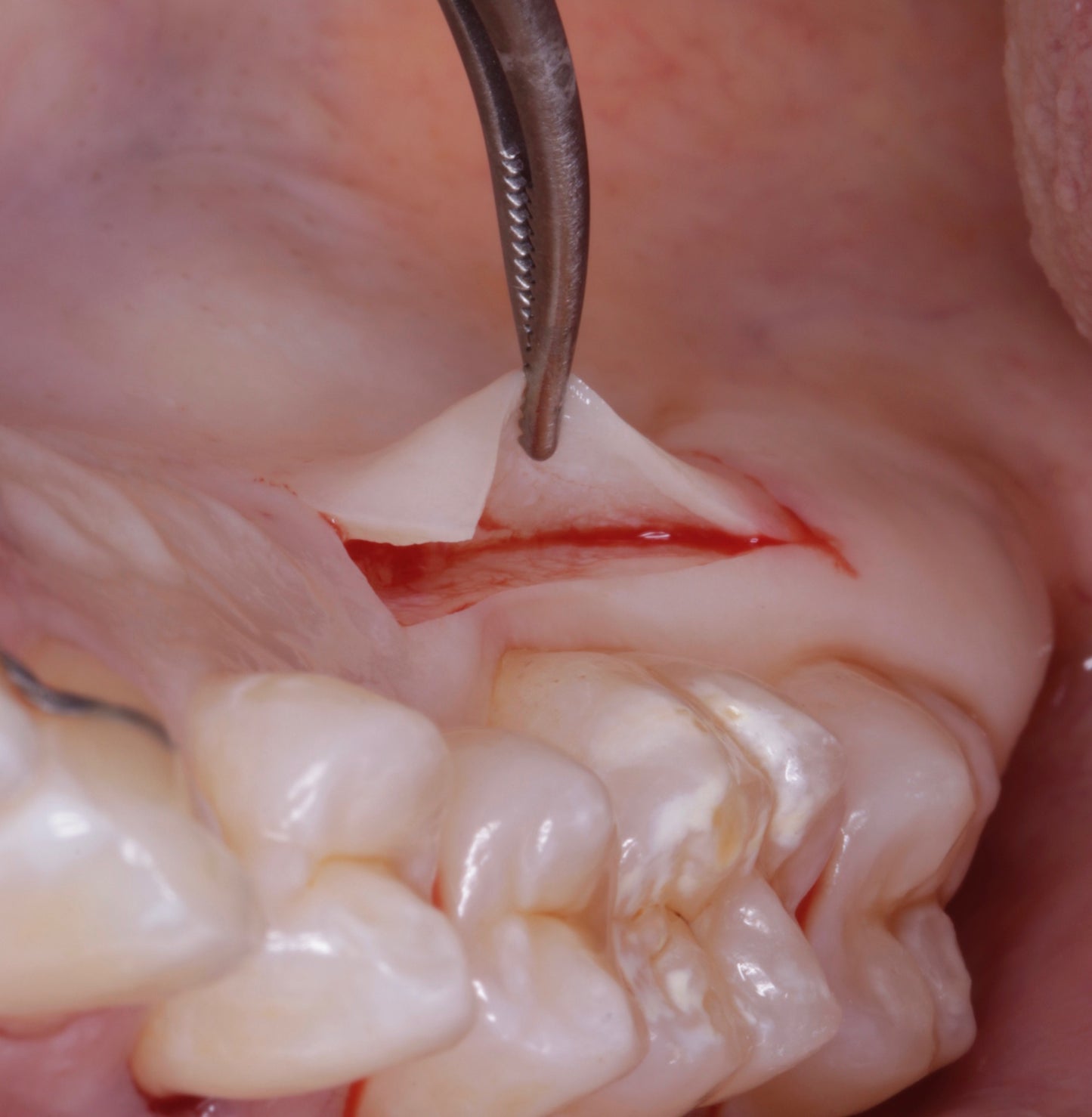 Anything Dental: Perio Pearls with Dr. Shereif Said— November 11, 2025