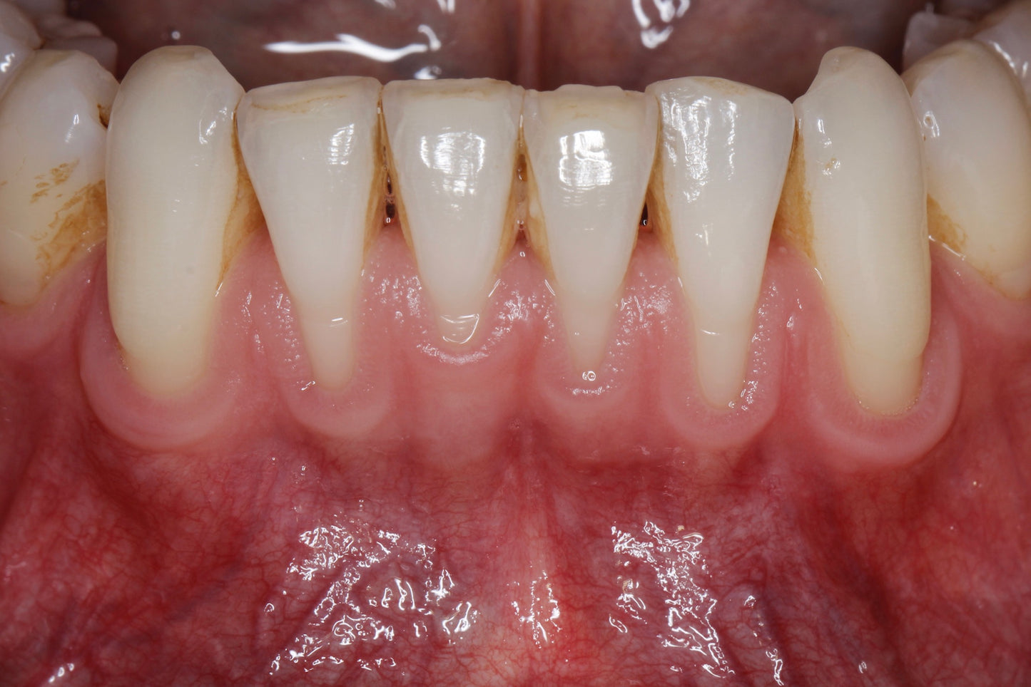 Anything Dental: Perio Pearls with Dr. Shereif Said— November 11, 2025