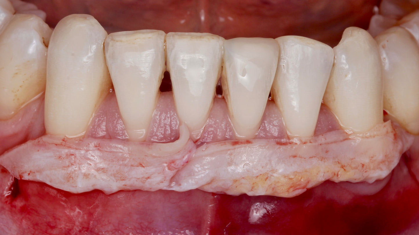 Anything Dental: Perio Pearls with Dr. Shereif Said— November 11, 2025