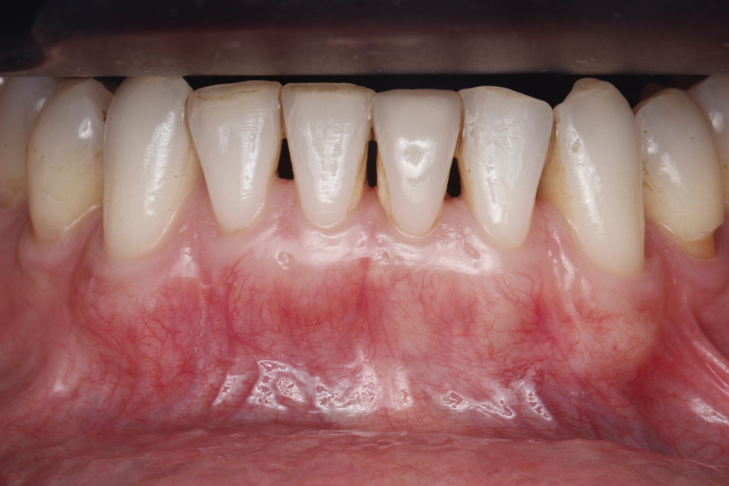 Anything Dental: Perio Pearls with Dr. Shereif Said— November 11, 2025