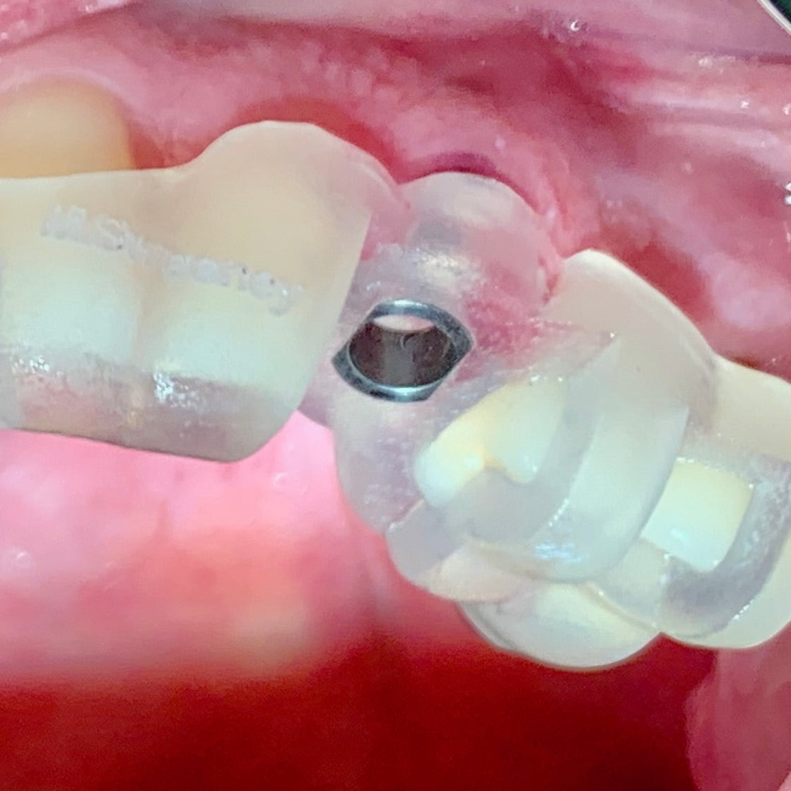 Surgical Video Library