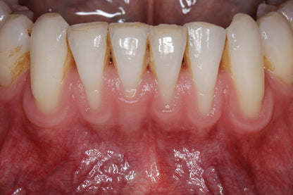 Anything Dental: Perio Pearls with Dr. Shereif Said— November 11, 2025