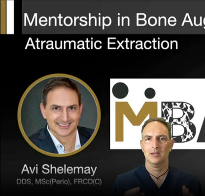 Mentorship in Bone Augmentation - Management of Socket Defects